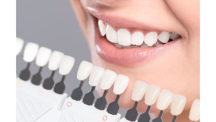 Come avere denti più bianchi?